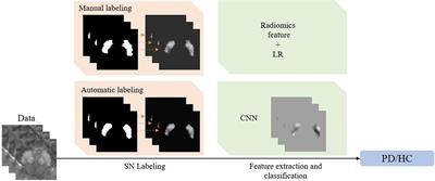 Stability of AI-Enabled Diagnosis of Parkinson’s Disease: A Study Targeting Substantia Nigra in Quantitative Susceptibility Mapping Imaging